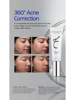 ZO Skin Health Retinol + Acne Complex - Сироватка проти запалень і висипань